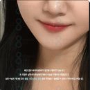 에이트성형외과의원 | 슈링크 600샷 후기? 가격? 붓기 부작용 줄이는 노하우 에이트성형외과 피부과