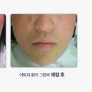 하이크린 이미지