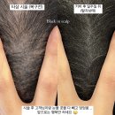 블랙인스칼프 이미지