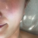 웅천남 7로 | [여수 웅천 피부관리] 웨디아 여수웅천점 윤곽관리 추천 및 후기