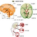 생활속의 질병예방 뇌혈관 질환 이미지