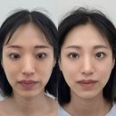건대 자연눈썹 조이로운 수지기법 리터치 내돈내산 후기 | 탈각 후 더 자연스러운 군자 눈썹 잘하는 곳