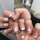 난이손톱