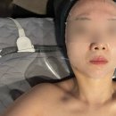 라벨르의원 | 춘천 퇴계동피부관리 라벨르 스킨케어에서 신부 물광관리 받은 후기