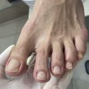 레푸스대전둔산점&더예쁜손발톱