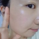 이어테라피 셀비오 이어밸런스 귀 지압 패치 얼굴 붓기 후기