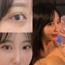 반포피부과 추천 / 다크서클필러 내돈내산 효과 만족 후기