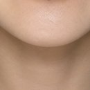 제이은 | 턱 모낭염 재발, 원인부터 잡은 제 후기