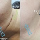 원 에스테틱 이미지