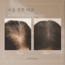 인천 두피문신 잘하는 곳 &lt;도트락 검단신도시점&gt;OPEN!!