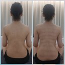 드림에스테틱 부천원종점 | 부천 원종동 문스파 :: 산후마사지 비포 애프터가 만족스러웠던 후기