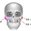 - 광대뼈성형/광대뼈축소 : 최소절개 안면윤곽 광대뼈성형의 개념은? 이미지