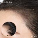 비앤미누보반영구학원 | 헤어라인문신으로 얼굴형 보정하는 방법