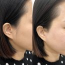 다온왁싱(waxing) | 동탄왁싱 다온왁싱, 2동탄왁싱 풀페이스 왁싱 후기