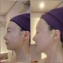 수원시 팔달구 중부대로143번길 | 수원피부관리 끌리고스킨&amp;뷰티 바이오필링 직접 받아봤더니