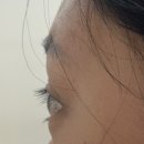 로우유