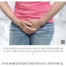 사타구니 착색 없애고 싶다면… ‘이런 팬티’ 입어야 이미지