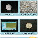 다나치과기공소 이미지