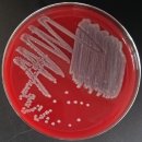 종어의 장내세균과의 Klebsiella variicola 이미지