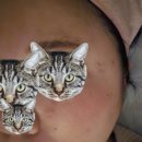 건담한의원 | 얼굴 편평사마귀 치료 [화접몽한의원 강남본점] 거우침치료 (면역치료, 아토피, 화폐성습진)