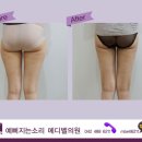 메디올의원 네이버블로그