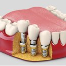 하나로치과기공소 이미지