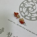 담덕치과의원 | 사랑니 뺀 썰 푼다