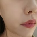 명동방앗간 아하(AHA) | 명동피부과 티타늄리프팅 5만줄, 아쿠아필, 신데렐라 주사로 완성한 리프팅과 피부톤 관리 후기