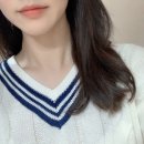 카멕 | 구순염 치료, 극복 후기 / 낫는 방법 있어요!!! (접촉성 구순염)