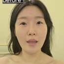 굿사운드메디칼 | 사운드바디 사운드스킨 성신 D.Origin 후기 – 더블임팩트 1회 진짜 효과!굿굿!