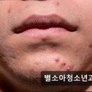 별소아청소년과의원 | 서산 추천 피부과 별소아청소년과의원 친절함과 꾸준함이 돋보인다