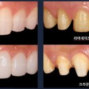 라미끄 이미지