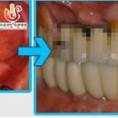 수플란트치과병원 이미지