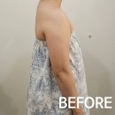 다산 제3공영주차장(주차타워)[다산-3] | 다산 웨딩관리 미올뷰티 결혼 준비 중이라면 필수~ 상체라인의 변화 후기