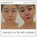 르디브 | 평택 소사벌 피부관리 르디브에스테틱 윤곽 하이푸리프팅 후기