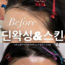 씨유펫인천 - 서구 고래울로 30 | 딘왁싱&스킨 :: 구월동 헤어라인 왁싱 | 헤어라인 정리 후기