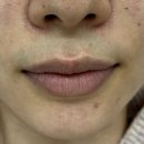 망우맞이방편의점 | 중랑풀페이스왁싱 망우 타임왁싱 헤어라인 정리까지