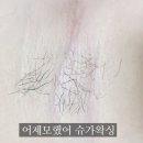 어제모했어슈가왁싱