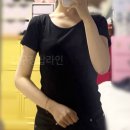 미즈슬림의원 | 팔뚝지방흡입가격 후기 슬림한 팔 라인 변화