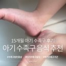 삼일어린이집 | 15개월 아기 수족구 후기｜증상, 먹을 수 있는 음식, 전염·잠복기 총정리