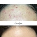 루므주아뷰티 | 창원피부관리 상남동피부관리 루므주아뷰티 (구 마메드로)