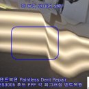 크라운덴트 이미지