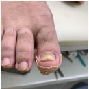 미엘네일닥터아이티엔범계지점 | 안양내성발톱 관리 엄청난 샵 미엘네일 닥터아이티엔 범계지점