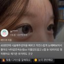 올단 이미지