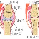 퇴행성관절염은 어떤 병인가? 이미지