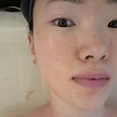 연제구-197 | 부산 웨딩관리 잘 하는곳 연제구 링크에스테틱 방문 후기