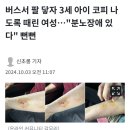 버스서 팔 닿자 3세 아이 코피 나도록 때린 여성…"분노장애 있다" 뻔뻔 이미지