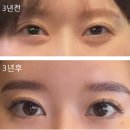 비본 | 아이라인 문신으로 꼬막눈 탈출 변천사 내돈내산 후기(ft.비본)