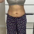 한끼묵은지김치찜 연천전곡점 | 지방추출주사 출산 후 다이어트 육아 병행 다이어트 지방추출주사 6주 차 양주 여행 연천 전곡선사 박물관