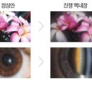 좋은눈안과의원 이미지